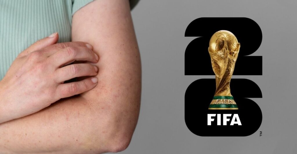 CDMX implementa vacuna obligatoria contra el sarampión rumbo al Mundial 2026 CDMX implementa vacuna obligatoria contra el sarampión rumbo al Mundial 2026